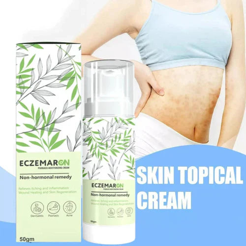 Ecze+ Anti Fungal Spray (Buy 1 Get 1 Freeš„š„)