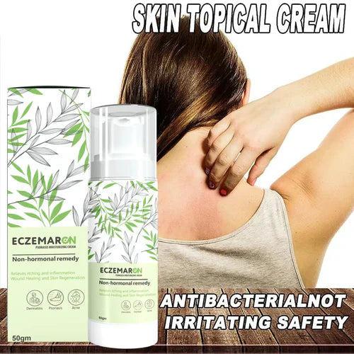 Ecze+ Anti Fungal Spray (Buy 1 Get 1 Freeš„š„)