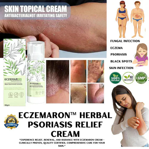 Ecze+ Anti Fungal Spray (Buy 1 Get 1 Free🔥🔥)